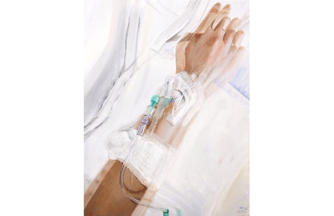 blurred painting of an arm with IV